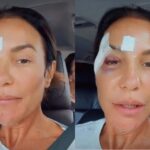 Ivete Sangalo recebe alta após mal-estar e queda